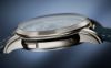 Picture of 5330G - Complications
